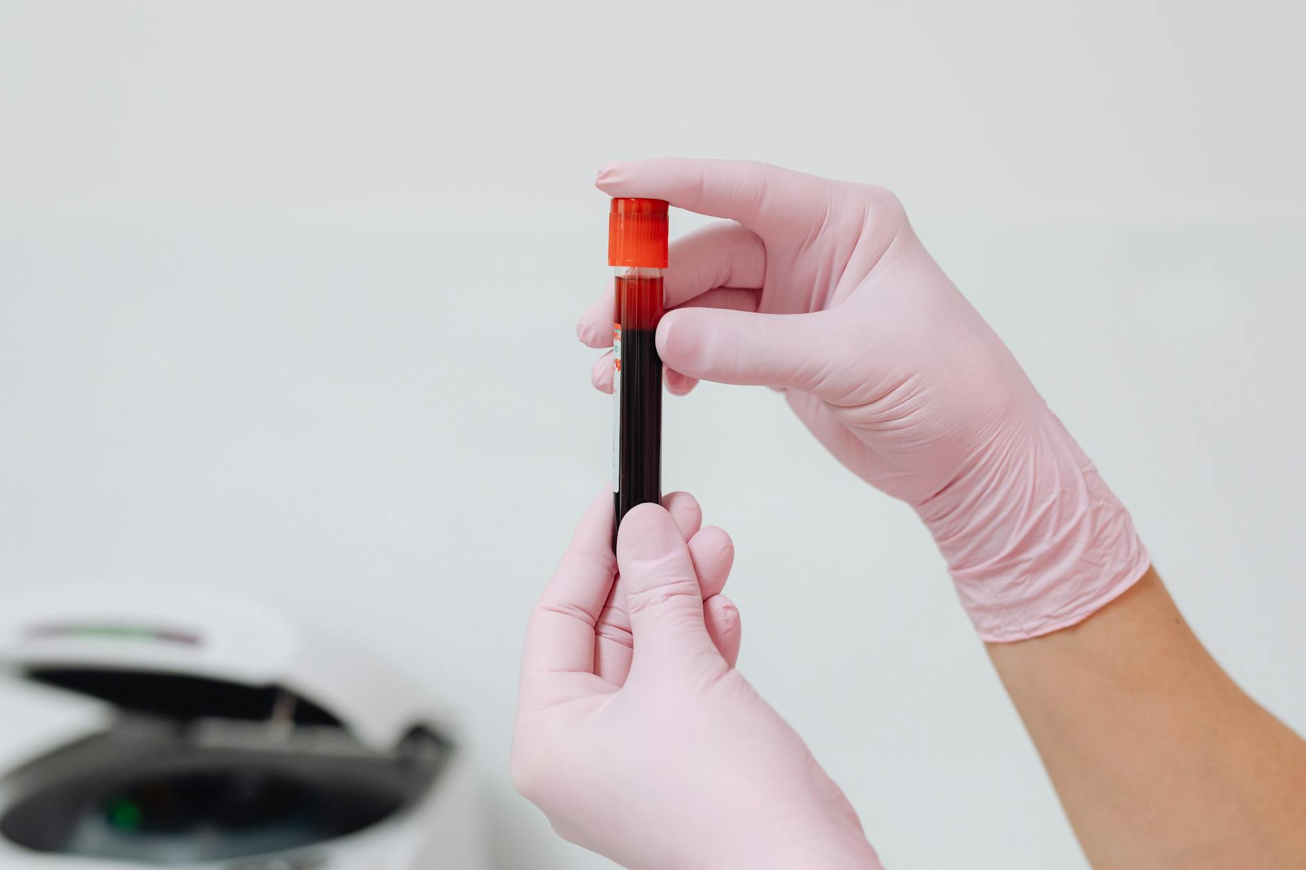 Biomarkers for Longevity: The Metrics That Actually Predict How Long You'll Live