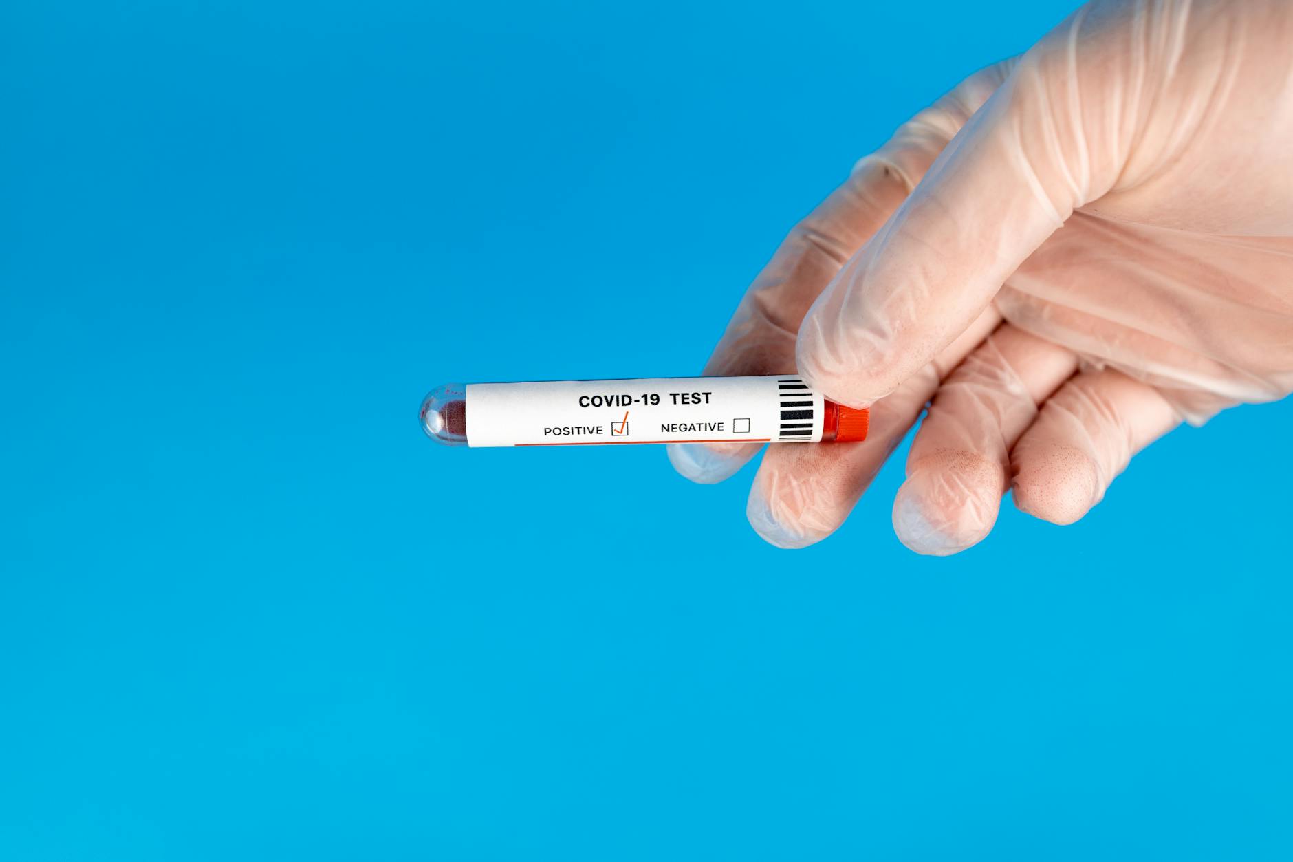 How to Read Blood Test Results: A Plain-Language Guide to Every Major Biomarker